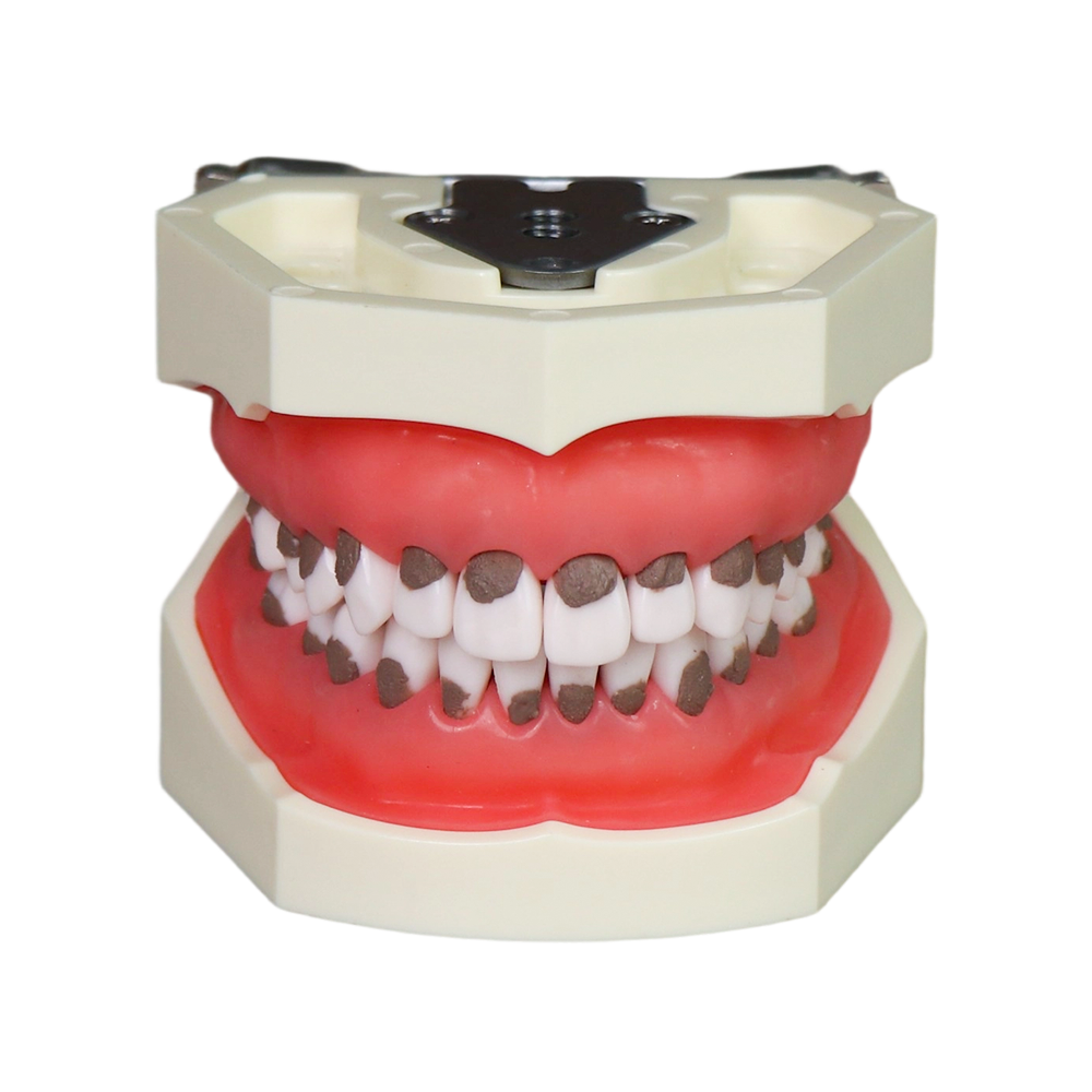 Asian Soft Gum Dental Calculus Model with FE Articulator – Removable Teeth for Scaling Practice