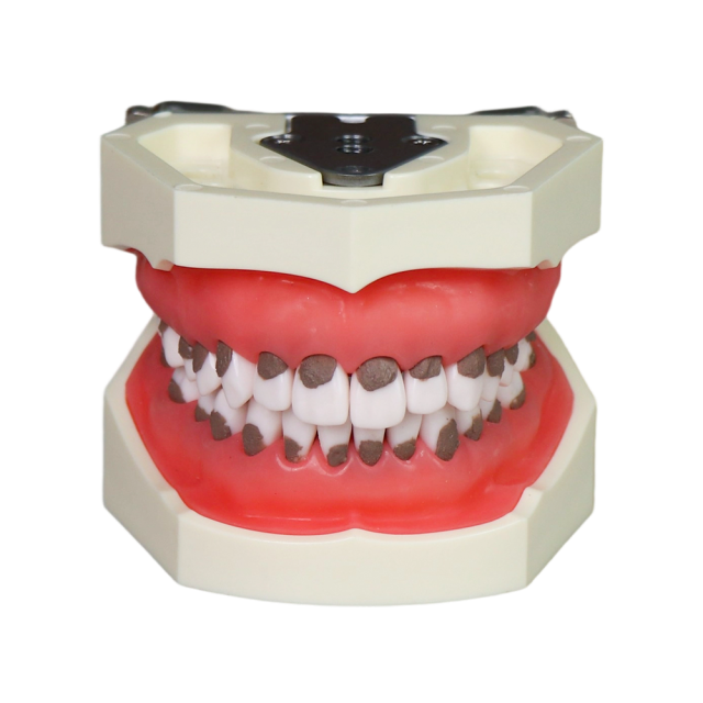 Asian Soft Gum Dental Calculus Model with FE Articulator – Removable Teeth for Scaling Practice
