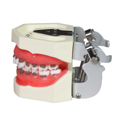 Asian Soft Gum Dental Calculus Model with FE Articulator – Removable Teeth for Scaling Practice