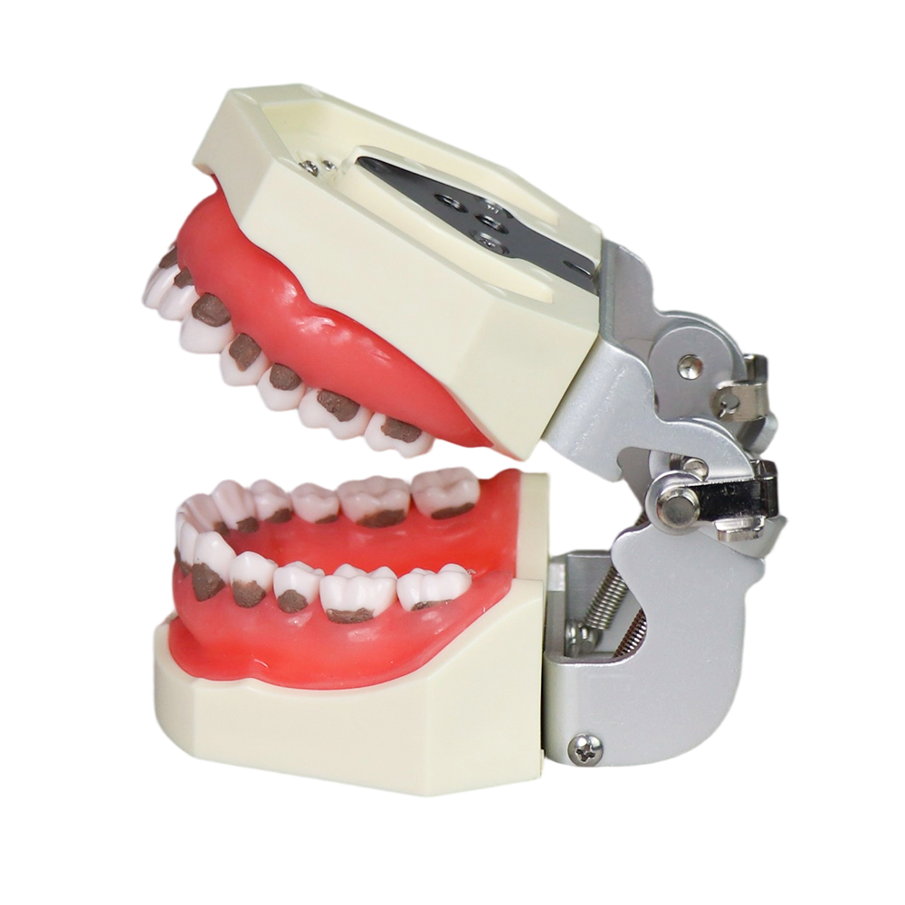 Asian Soft Gum Dental Calculus Model with FE Articulator – Removable Teeth for Scaling Practice