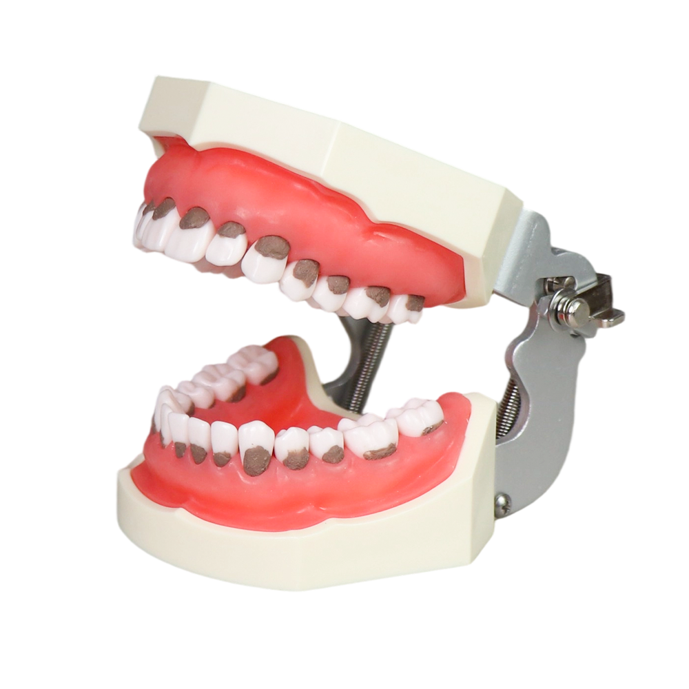 Asian Soft Gum Dental Calculus Model with FE Articulator – Removable Teeth for Scaling Practice