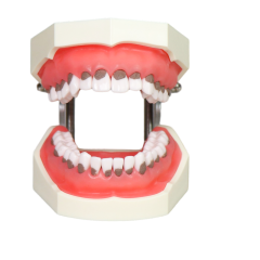 Asian Soft Gum Dental Calculus Model with FE Articulator – Removable Teeth for Scaling Practice