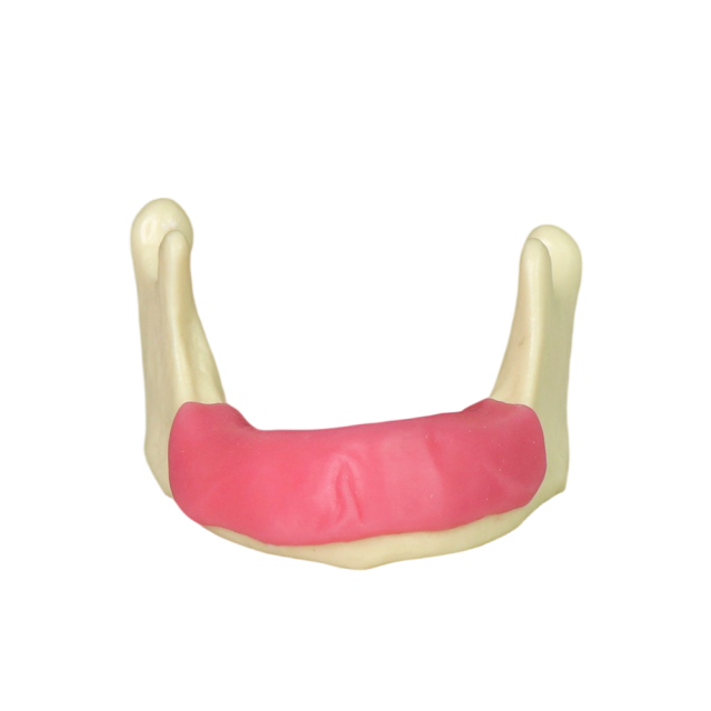 implant Model