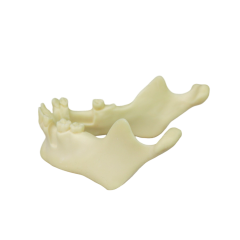 Mandibular Dental Implant Model – Foamed Resin for Implant Practice JG-Y12-T