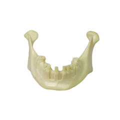 Mandibular Dental Implant Model – Foamed Resin for Implant Practice JG-Y12-T