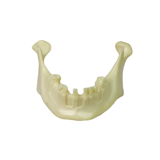 Mandibular Dental Implant Model – Foamed Resin for Implant Practice JG-Y12-T