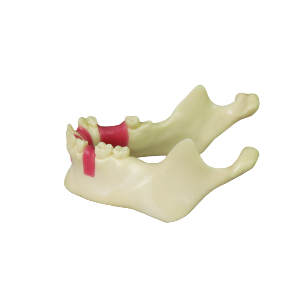 Mandibular Dental Implant Model – Foamed Resin for Implant Practice JG-Y12-TG
