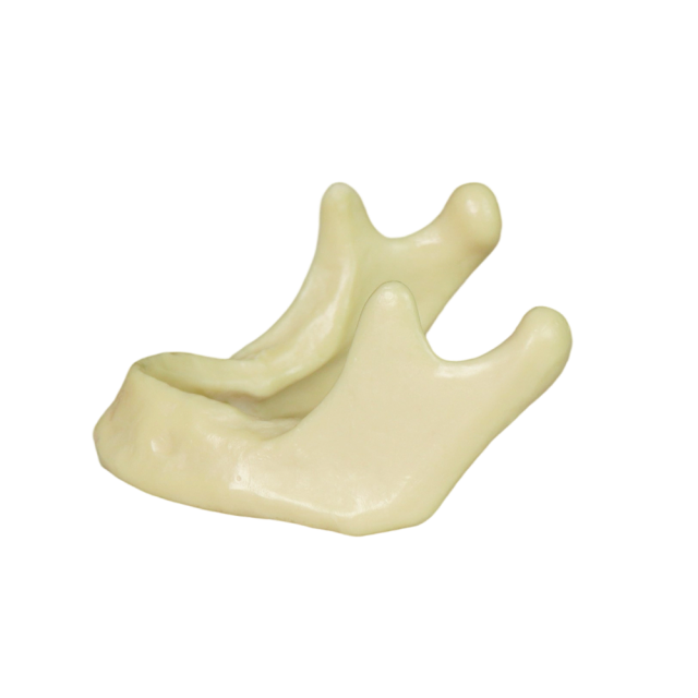 Mandibular Dental Implant Model – Foamed Resin for Implant Training
