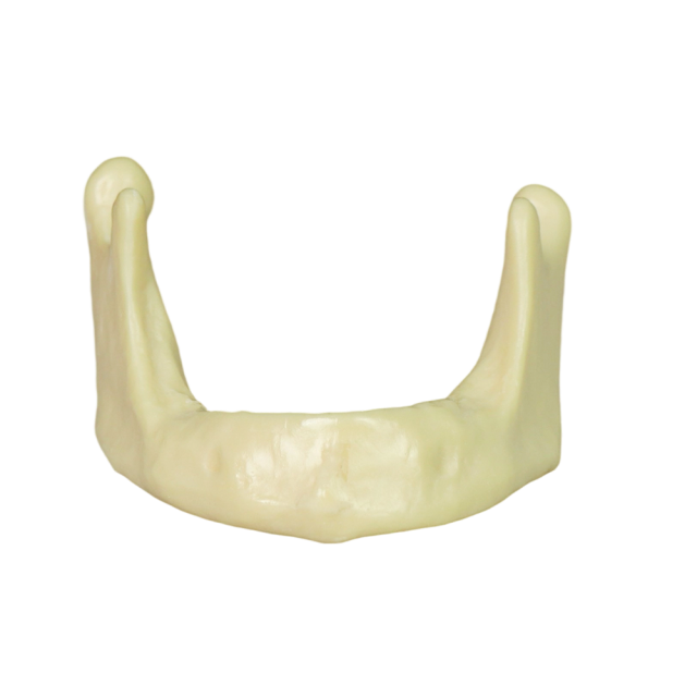 Mandibular Dental Implant Model – Foamed Resin for Implant Training