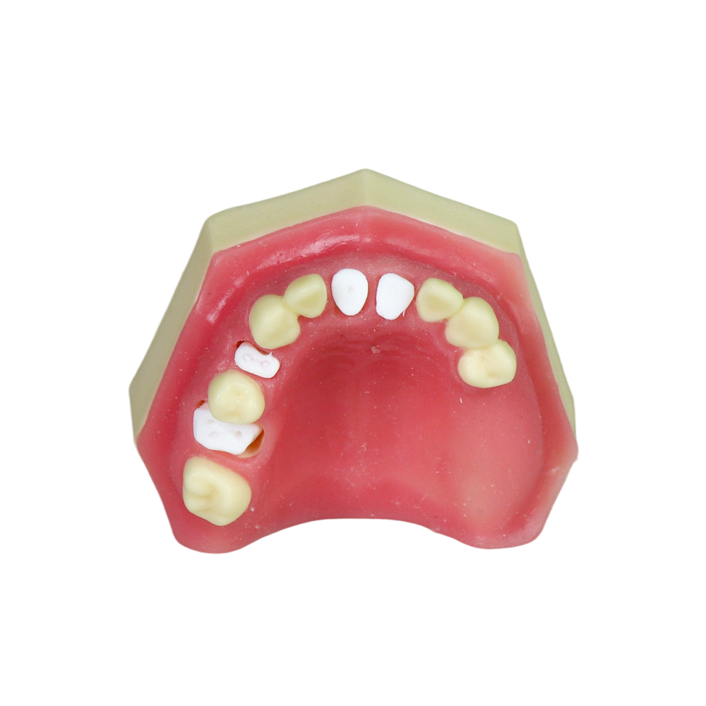Sinus Lift Dental Model – Hard Resin with Soft Gums for Maxillary Sinus Training JG-Y8-F5