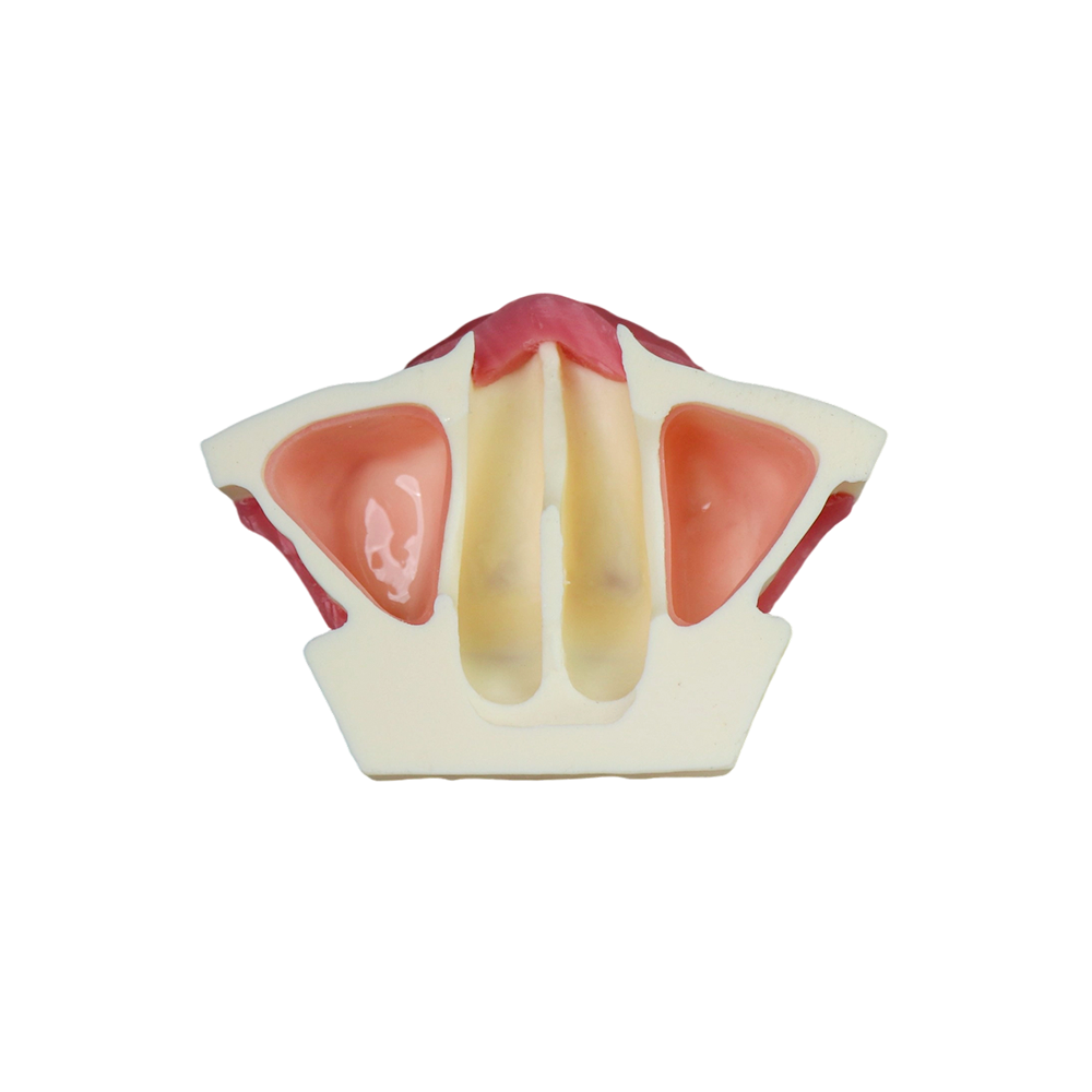 Sinus Lift Dental Model – Hard Resin with Soft Gums for Maxillary Sinus Training JG-Y26