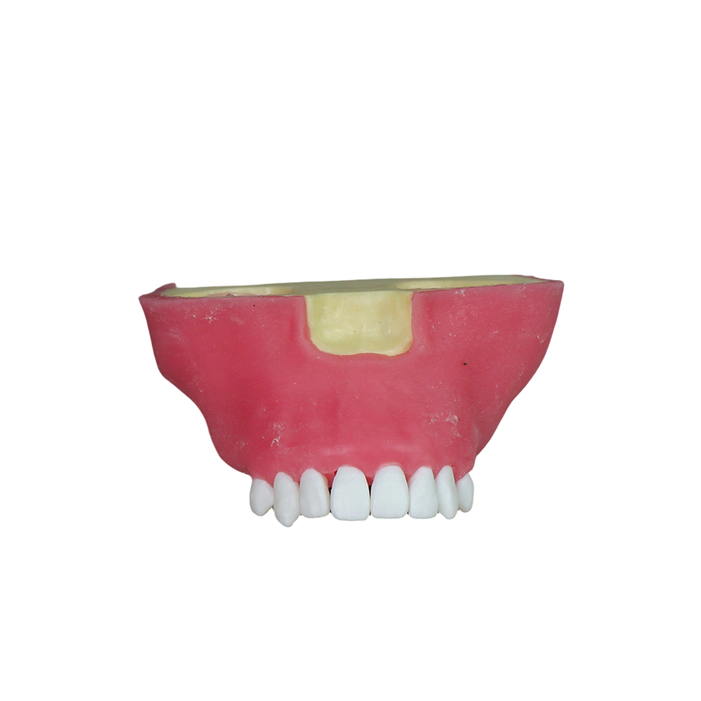 Sinus Lift Dental Model – Hard Resin with Soft Gums for Maxillary Sinus Training JG-Y27