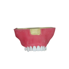 Sinus Lift Dental Model – Hard Resin with Soft Gums for Maxillary Sinus Training JG-Y27