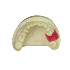 Dental Implant Model – D2 Soft Resin with Gums for Implant Training JG-Y8-F9
