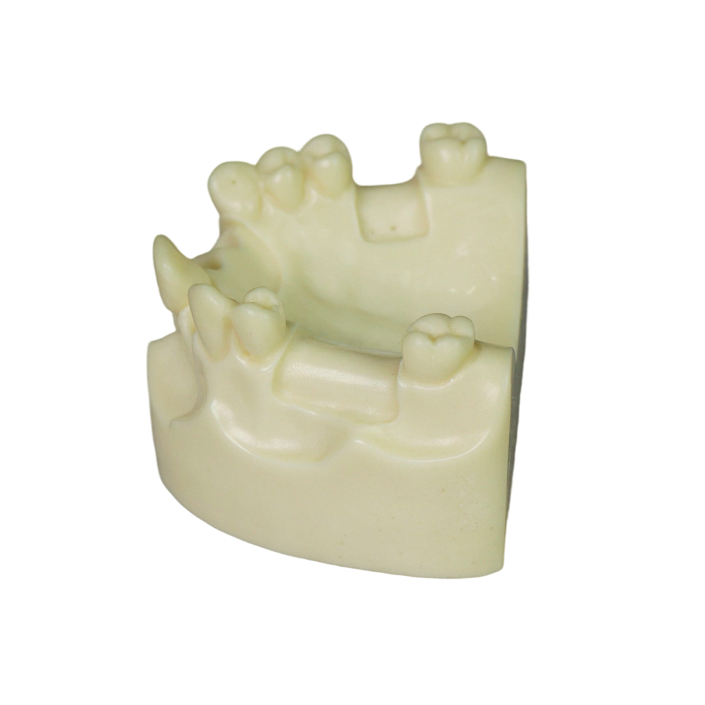 Dental Implant Model – D2 Soft Resin with Gums for Implant Training JG-Y8-F1-4