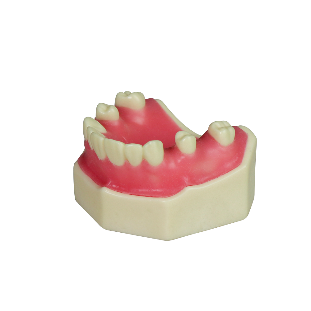 Sinus Lift Dental Model – Hard Resin with Soft Gums for Maxillary Sinus Training JG-YZ-1