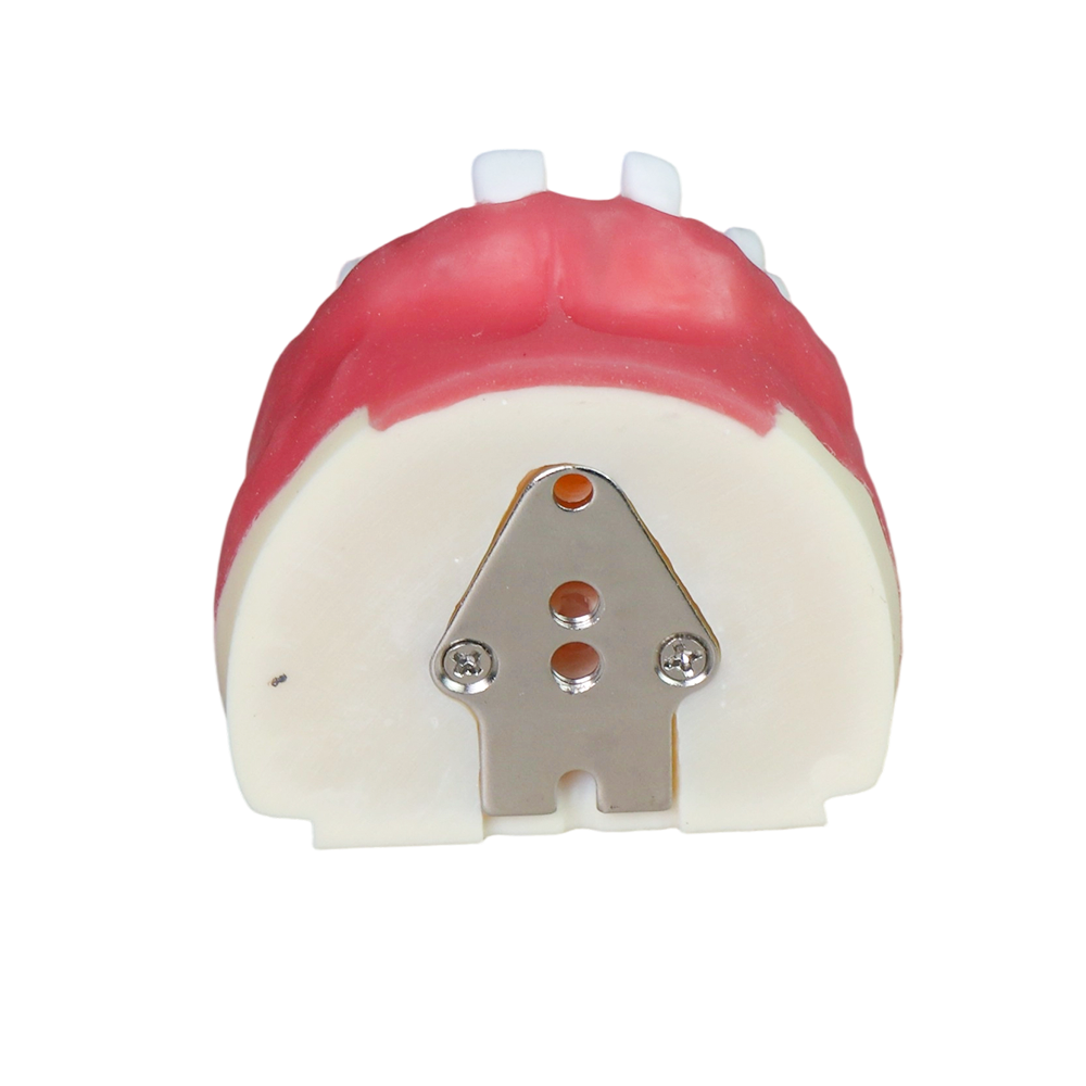 Dental Implant Training Model – Hard Resin with Soft Gum for Implant Practice JG-Y8-F2