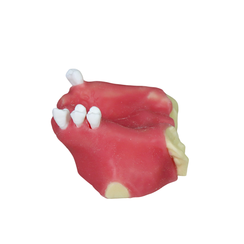 Sinus Lift Dental Model – Hard Resin with Soft Gums for Maxillary Sinus Training JG-Y11-S2
