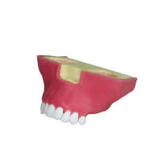Sinus Lift Dental Model – Hard Resin with Soft Gums for Maxillary Sinus Training JG-Y27