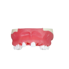 Dental Implant Training Model – Hard Resin with Soft Gum for Implant Practice JG-Y8-F2