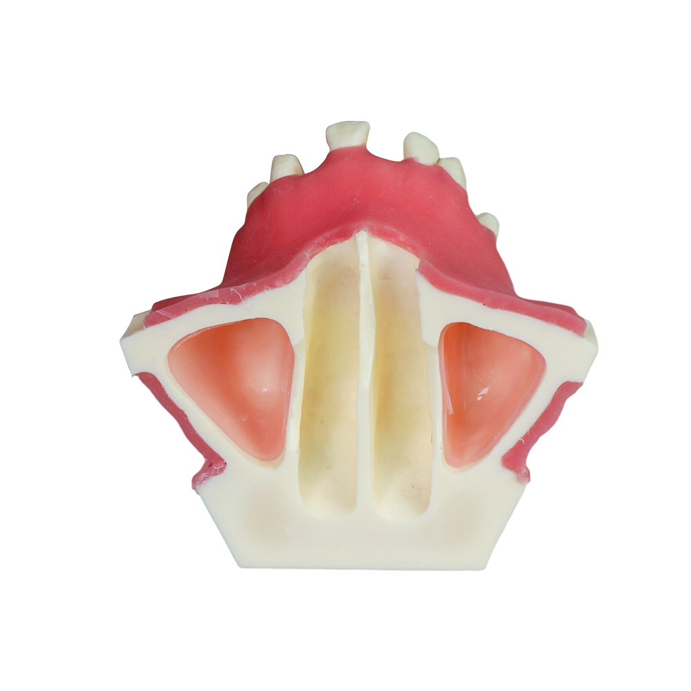 Sinus Lift Dental Model – Hard Resin with Soft Gums for Maxillary Sinus Training JG-Y11-S1