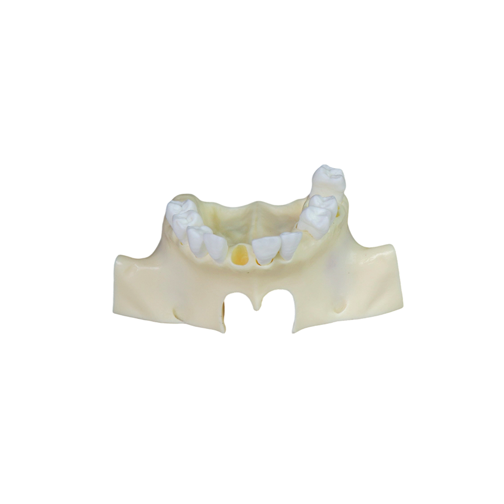 Sinus Lift Dental Model – Hard Resin with Soft Gums for Maxillary Sinus Training JG-Y11-S1-1