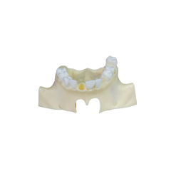 Sinus Lift Dental Model – Hard Resin with Soft Gums for Maxillary Sinus Training JG-Y11-S1-1