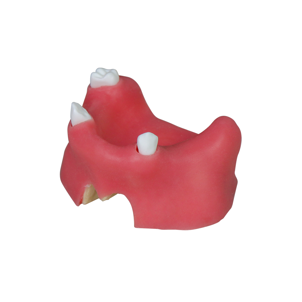 Sinus Lift Dental Model – Hard Resin with Soft Gums for Maxillary Sinus Training JG-YZ-11