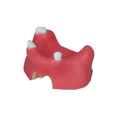 Sinus Lift Dental Model – Hard Resin with Soft Gums for Maxillary Sinus Training JG-YZ-11