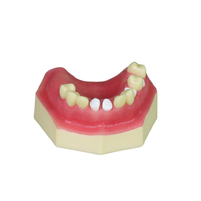 Sinus Lift Dental Model – Hard Resin with Soft Gums for Maxillary Sinus Training JG-Y8-F5
