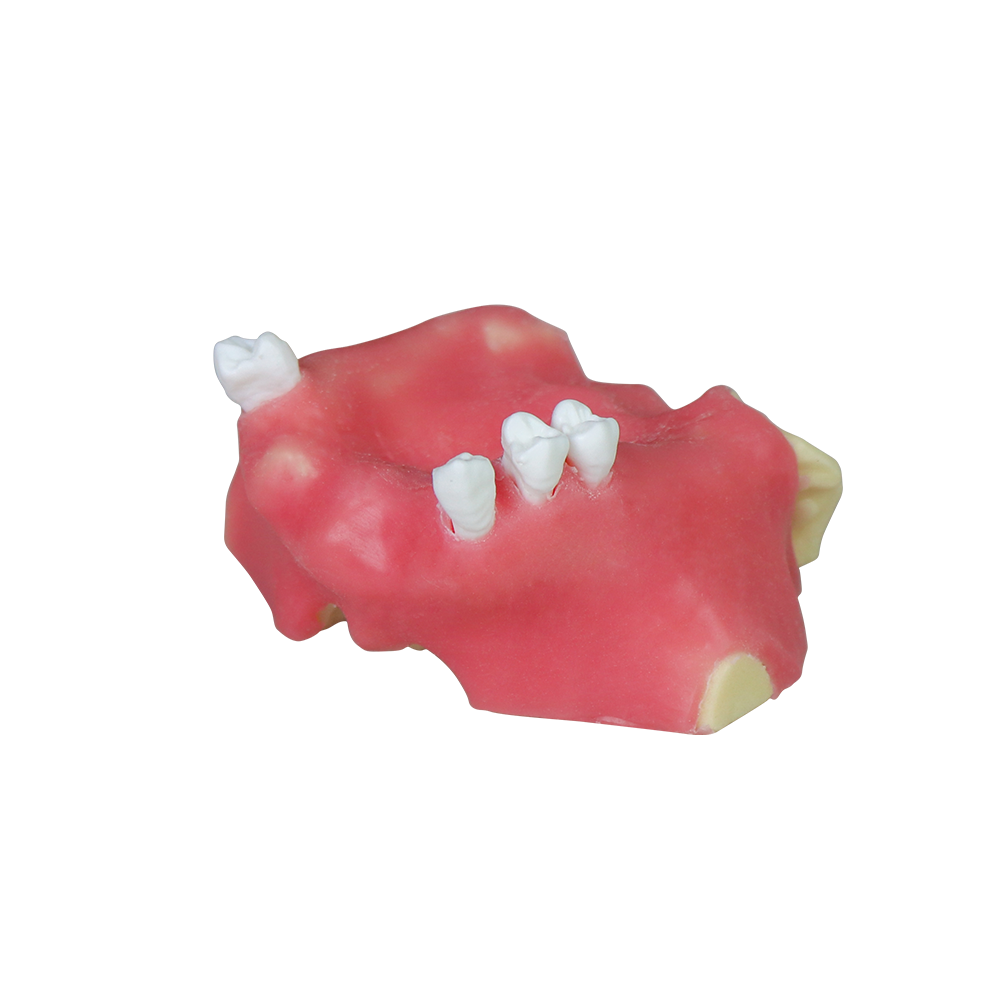 Sinus Lift Dental Model – Hard Resin with Soft Gums for Maxillary Sinus Training JG-Y11-S2