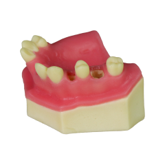 Sinus Lift Dental Model – Hard Resin with Soft Gums for Maxillary Sinus Training JG-Y8-F10