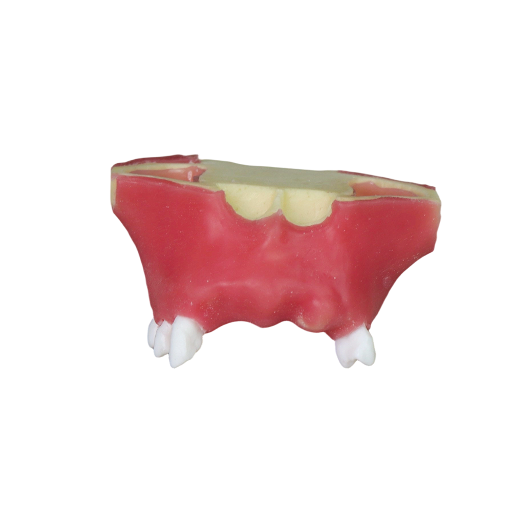 Sinus Lift Dental Model – Hard Resin with Soft Gums for Maxillary Sinus Training JG-Y11-S2