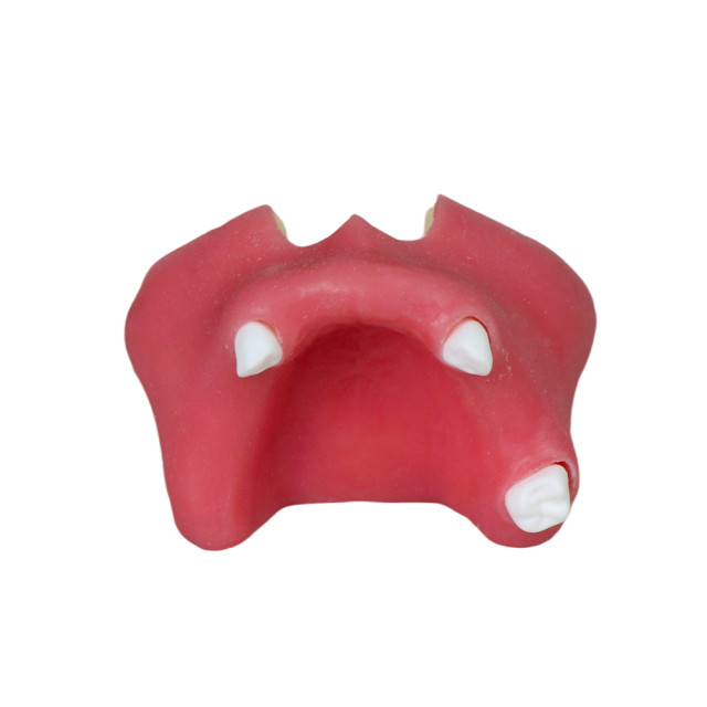 Sinus Lift Dental Model – Hard Resin with Soft Gums for Maxillary Sinus Training JG-YZ-11