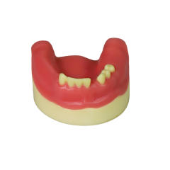 Dental Implant Model – D2 Soft Resin with Gums for Implant Training JG-Y8-F4