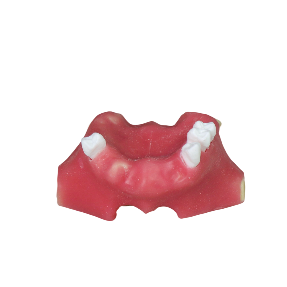 Sinus Lift Dental Model – Hard Resin with Soft Gums for Maxillary Sinus Training JG-Y11-S2
