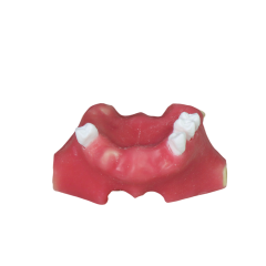 Sinus Lift Dental Model – Hard Resin with Soft Gums for Maxillary Sinus Training JG-Y11-S2