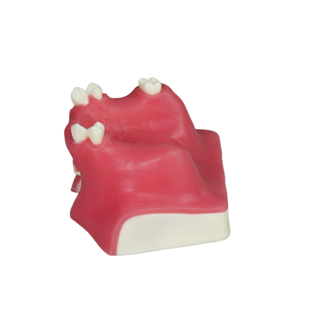 Sinus Lift Dental Model – Hard Resin with Soft Gums for Maxillary Sinus Training JG-Y21