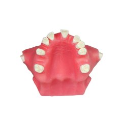 Sinus Lift Dental Model – Hard Resin with Soft Gums for Maxillary Sinus Training JG-Y11-S1
