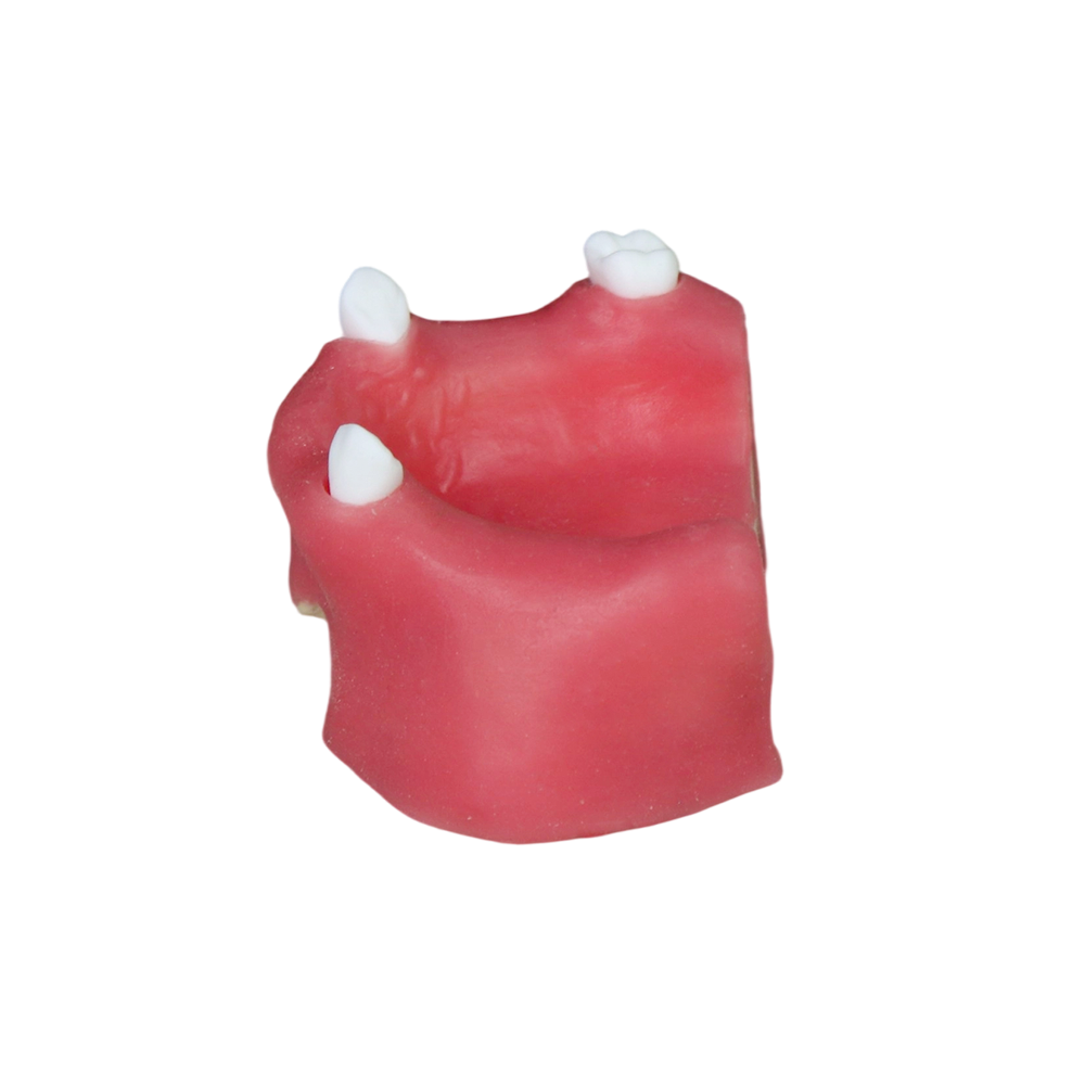 Sinus Lift Dental Model – Hard Resin with Soft Gums for Maxillary Sinus Training JG-YZ-11