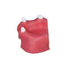 Sinus Lift Dental Model – Hard Resin with Soft Gums for Maxillary Sinus Training JG-YZ-11