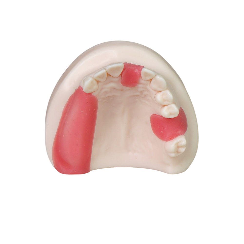 Dental Implant Model – D1 Soft Resin with Gums for Implant Training JG-Y8-F6