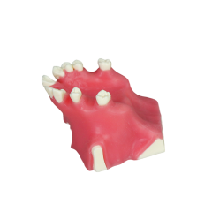 Sinus Lift Dental Model – Hard Resin with Soft Gums for Maxillary Sinus Training JG-Y11-S1