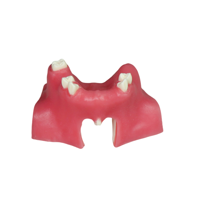 Sinus Lift Dental Model – Hard Resin with Soft Gums for Maxillary Sinus Training JG-Y21