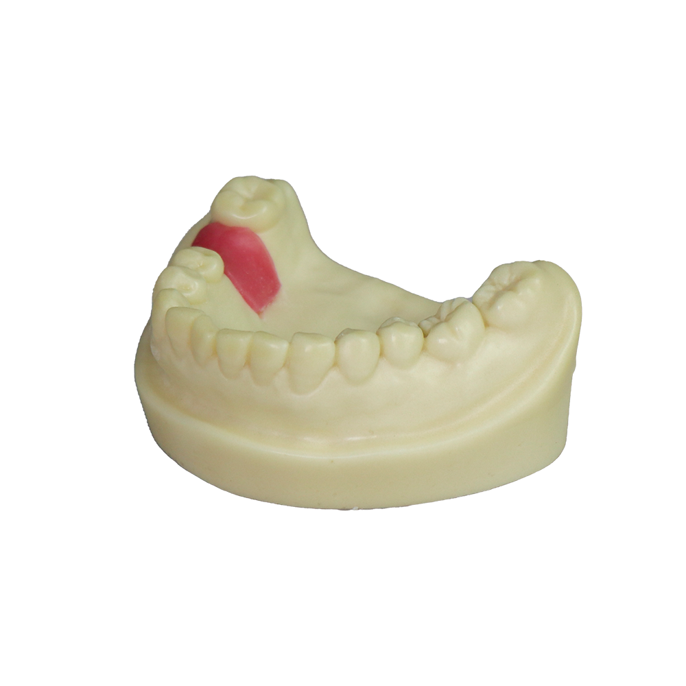 Dental Implant Model – D2 Soft Resin with Gums for Implant Training JG-Y8-F9