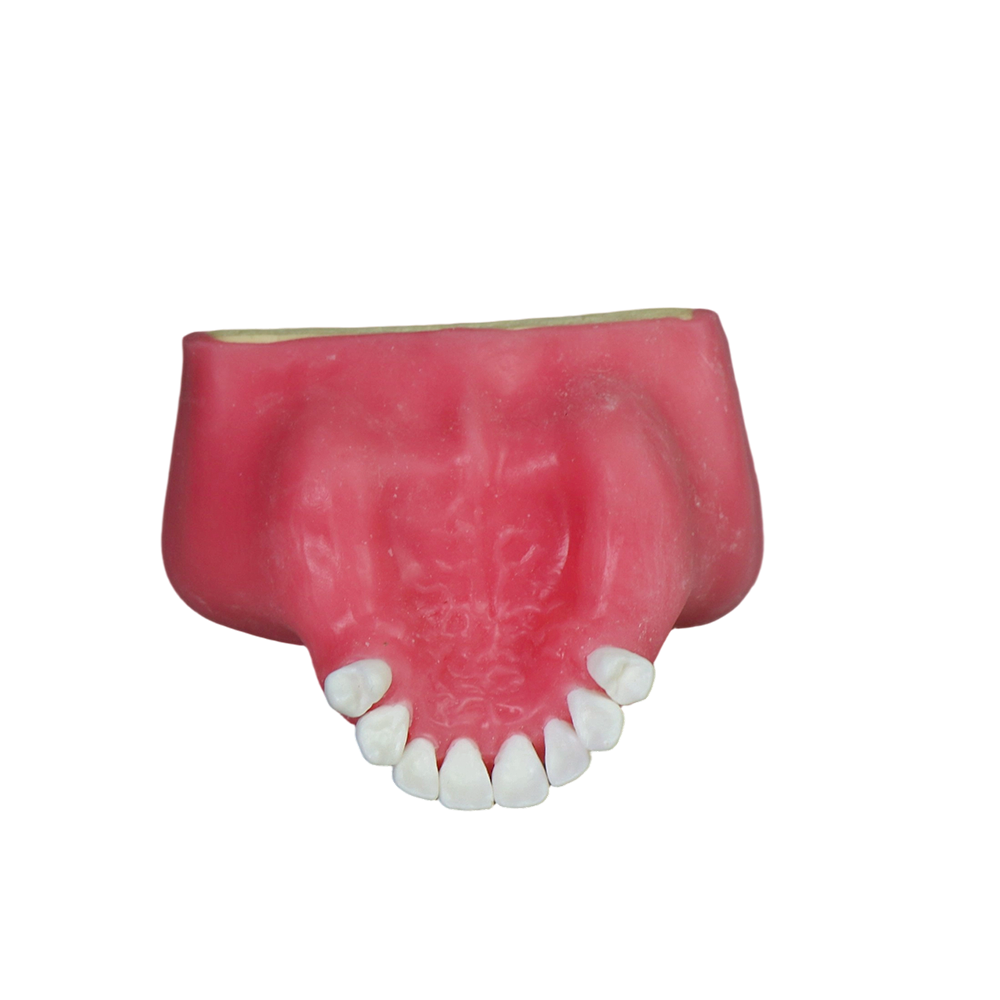Sinus Lift Dental Model – Hard Resin with Soft Gums for Maxillary Sinus Training JG-Y27