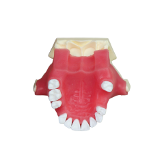 Sinus Lift Dental Model – Hard Resin with Soft Gums for Maxillary Sinus Training JG-Y26