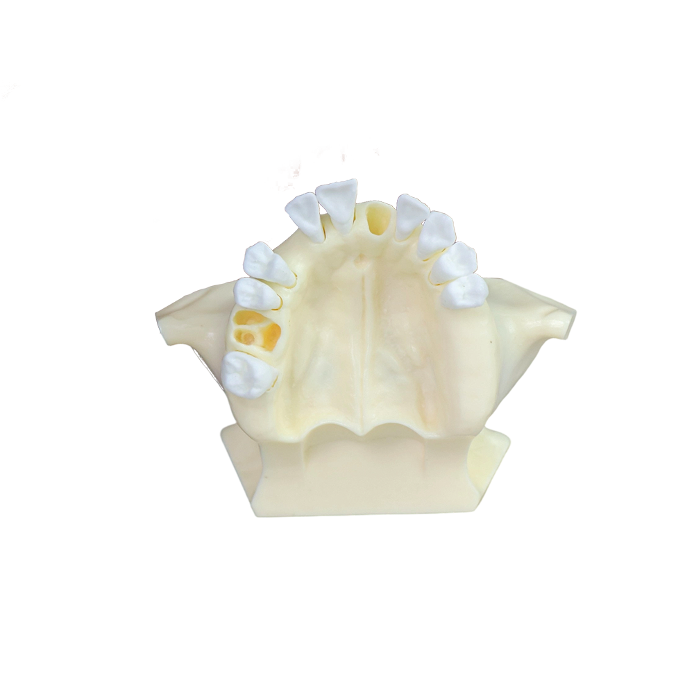 Sinus Lift Dental Model – Hard Resin with Soft Gums for Maxillary Sinus Training JG-Y11-S1-1