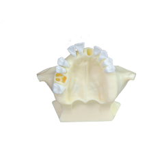 Sinus Lift Dental Model – Hard Resin with Soft Gums for Maxillary Sinus Training JG-Y11-S1-1