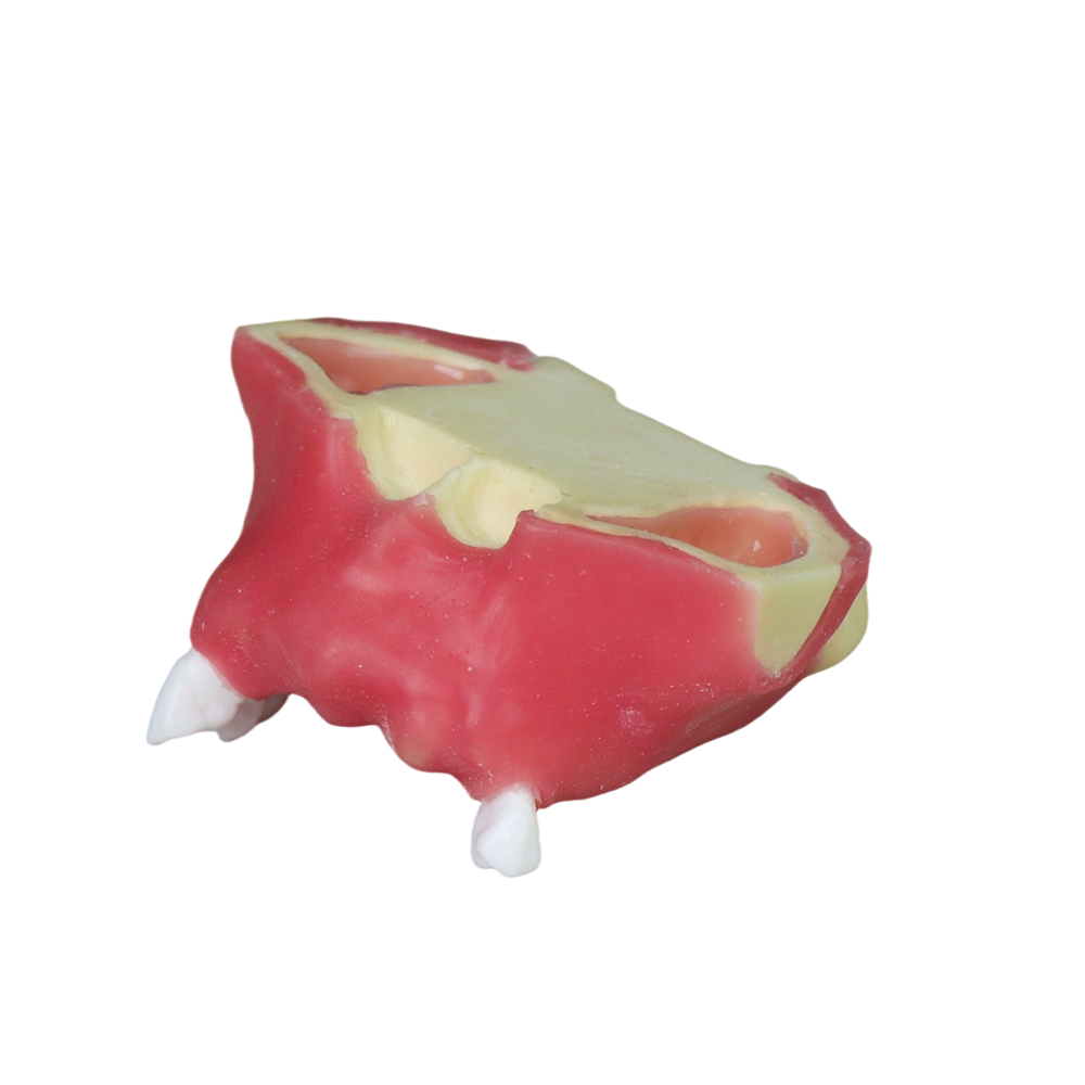 Sinus Lift Dental Model – Hard Resin with Soft Gums for Maxillary Sinus Training JG-Y11-S2